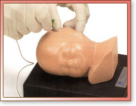 Bebé Ivy - acceso venoso periférico neonatal