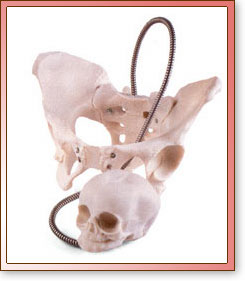 Pelvis femenina con Cráneo Fetal